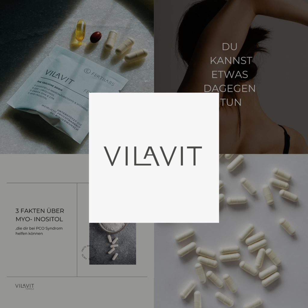 Social Media Marketing BYNA